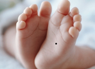 Ý nghĩa của vị tí nốt ruồi ở lòng bàn chân