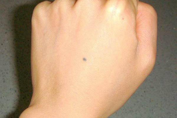 Xem bói vị trí nốt ruồi trên mu bàn tay