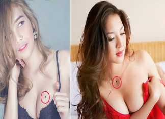 Nốt ruồi đỏ ở ngực phụ nữ nói lên điều gì?