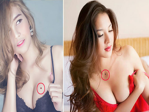Nốt ruồi đỏ ở ngực phụ nữ nói lên điều gì?