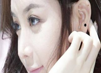 Nốt ruồi ở tai phụ nữ nói lên điều gì là tốt hay xấu? not-ruoi-o-tai-phu-nu-noi-len-dieu-gi