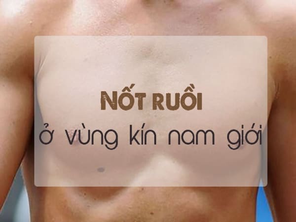 Ý nghĩa nốt ruồi tại vùng kín nam giới