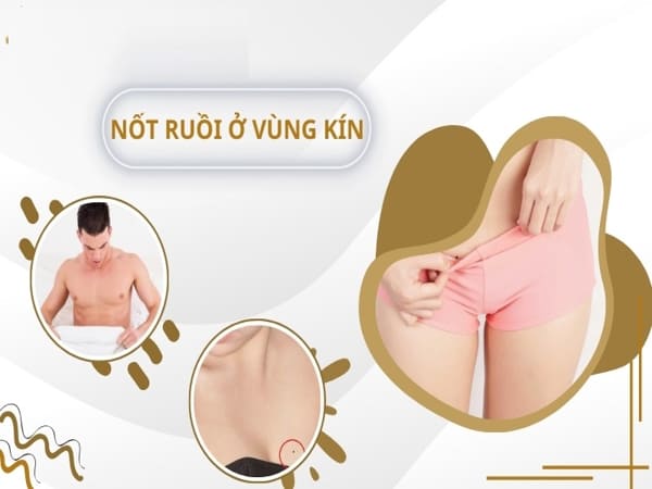 Ý nghĩa nốt ruồi ở vùng kín nam và nữ