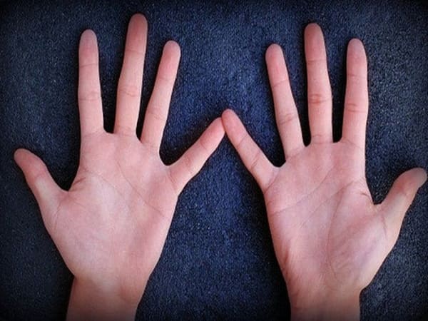 Xem tướng bàn tay xấu