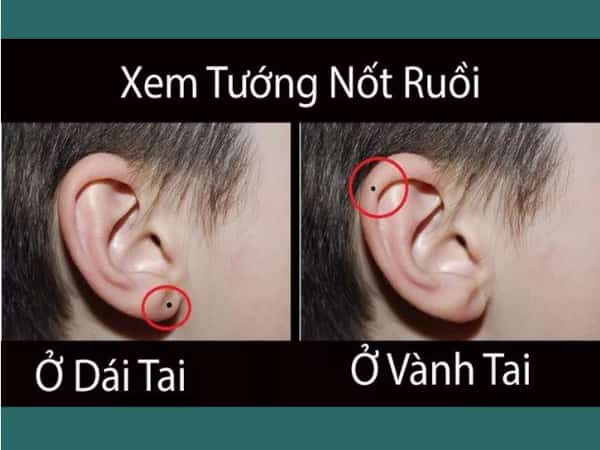 Xem tướng nốt ruồi ở tai
