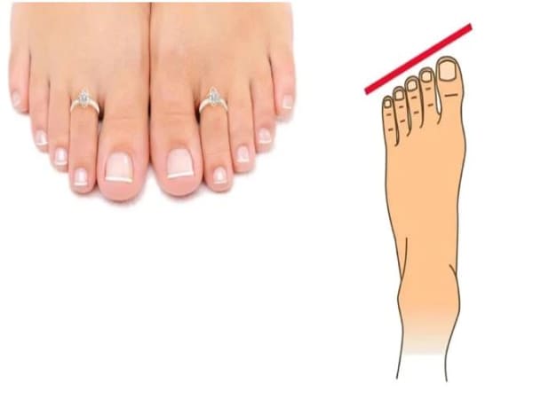 Xem tướng bàn chân đoán vận mệnh, tài lộc tương lai