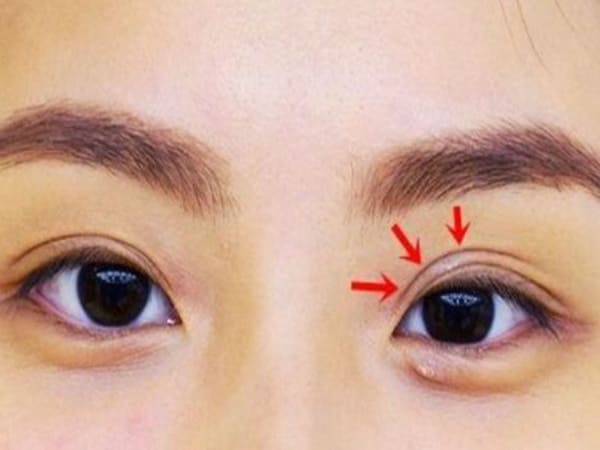 Ý nghĩa tính cách của người có tướng mắt nhiều mí