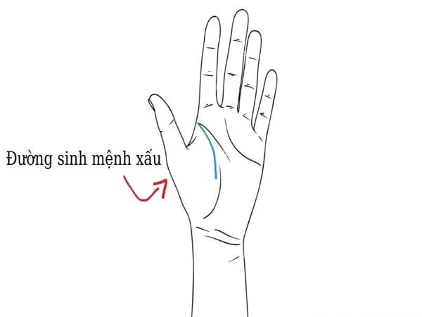 Những đường chỉ tay xấu - Đường số mệnh không rõ hoặc đứt đoạn
