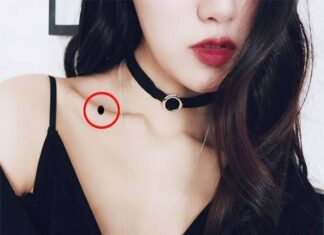 Tìm hiểu nốt ruồi ở xương quai xanh có ý nghĩa thế nào nốt ruồi ở xương quai xanh