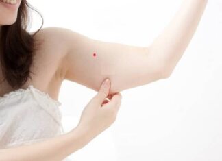 Giải mã nốt ruồi son trên cánh tay bạn có gì đặc biệt? Giải mã nốt ruồi son trên cánh tay bạn có gì đặc biệt?