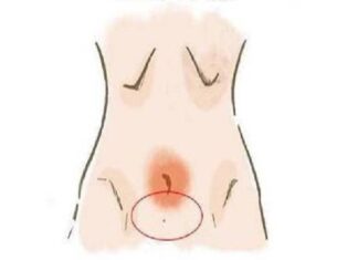 Nốt ruồi ở vùng kín có thể tiết lộ gì về vận mệnh bạn? nốt ruồi ở vùng kín