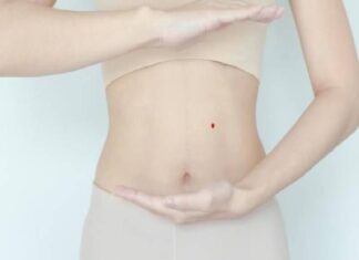 Tướng số nốt ruồi son ở bụng dự báo tài lộc thăng hoa? nốt ruồi son ở bụng