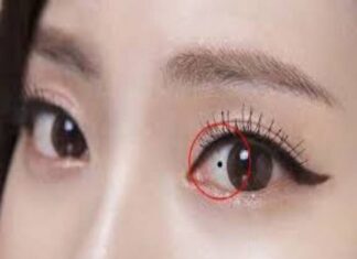 Coi bói nốt ruồi trong mắt đoán vận mệnh tính cách đúng nốt ruồi trong mắt